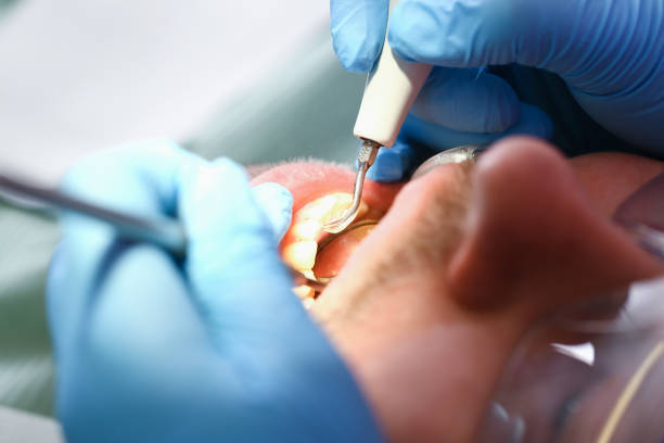 Tooth Infection Emergency Dentist in IL