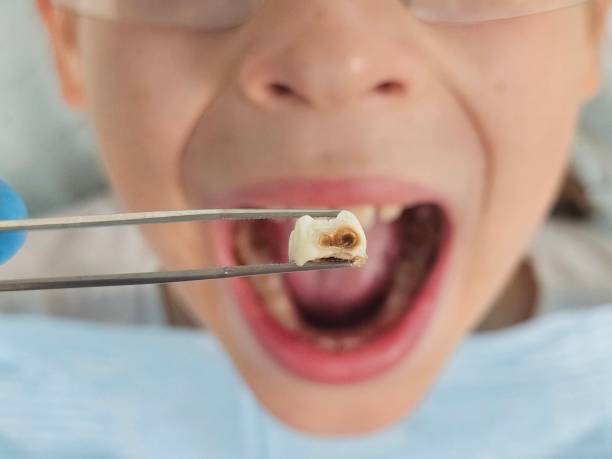 Best Emergency Pediatric Dentist  in Channahon, IL